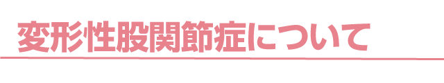変形性股関節症について