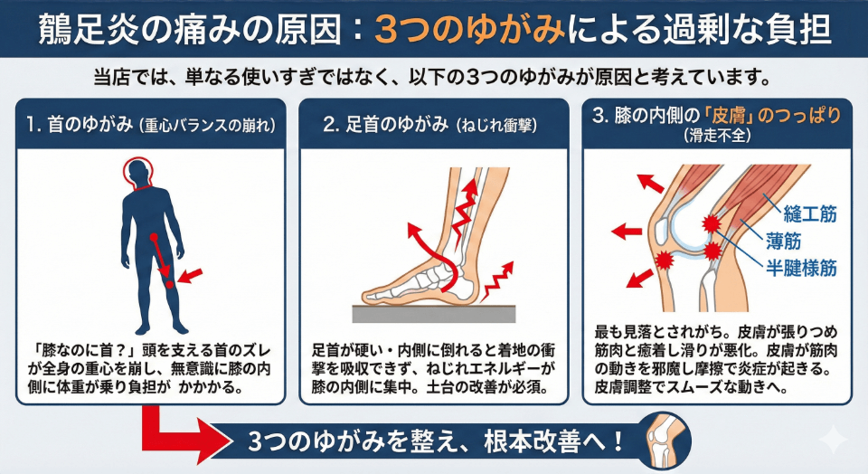 鵞足炎の痛みの原因の説明
