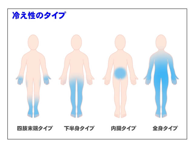 冷え性のタイプ